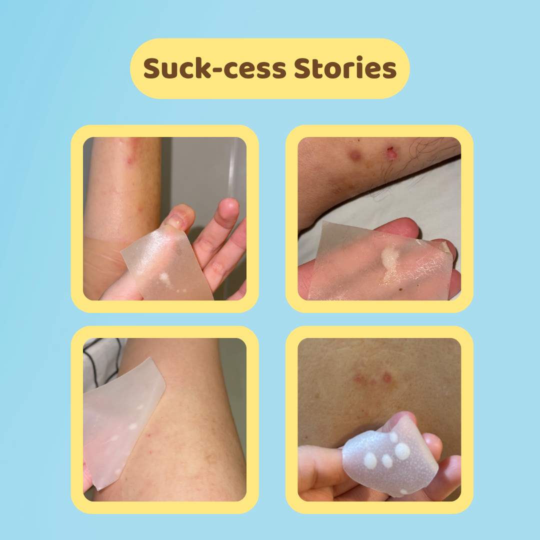 Hydrocolloid Roll