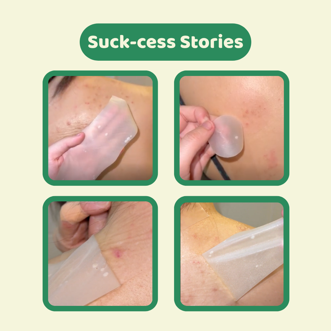 Hydrocolloid Roll